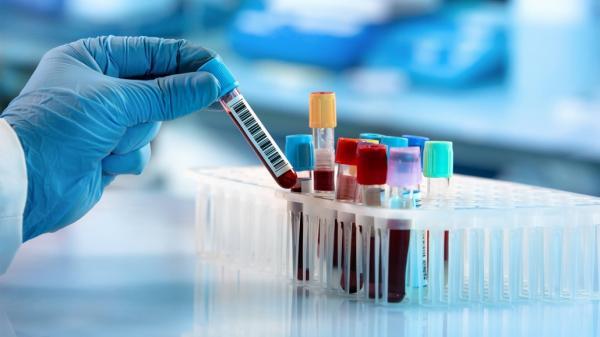 تشخیص پنجاه نوع سرطان با آزمایش تازه خون