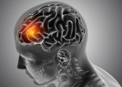 توافق نامه ای با هدف بهینه سازی اثرات رادیوتراپی تومور های مغزی امضا شد